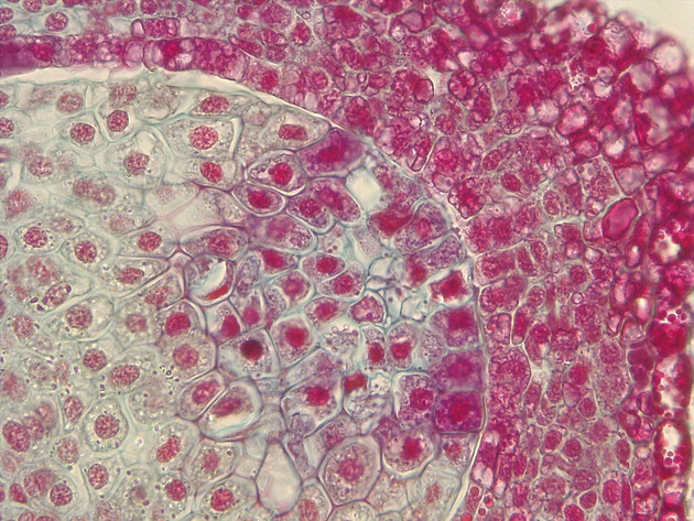 Female Pine Ovule Slides - Female Pine Ovule 02 400X